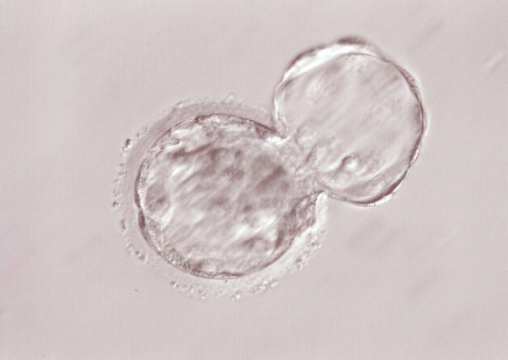 胚盤胞　ハッチアウト