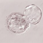 胚盤胞　ハッチアウト